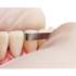 Compo Strips 6/pk- Premier - Dental Supplies