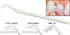 Periowise Probe-Premier Dental-Dental Supplies	