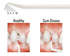 Periowise Probe-Premier Dental-Dental Supplies	