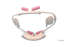ComfortView® Lip & Cheek Retractor - Premier Dental