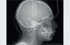 Duray 2D Ceph Extraoral X-Ray Series - Beyes Dental